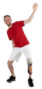 Male prosthesis wearer demonstrating balance